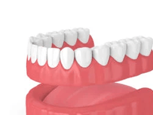 Dentures (Normal, Flexible, Monoplast)