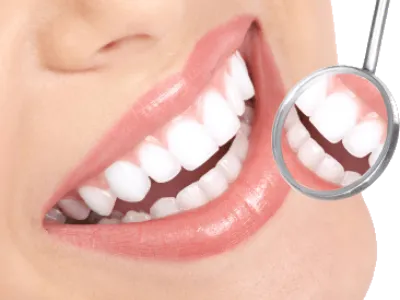 Teeth Whitening